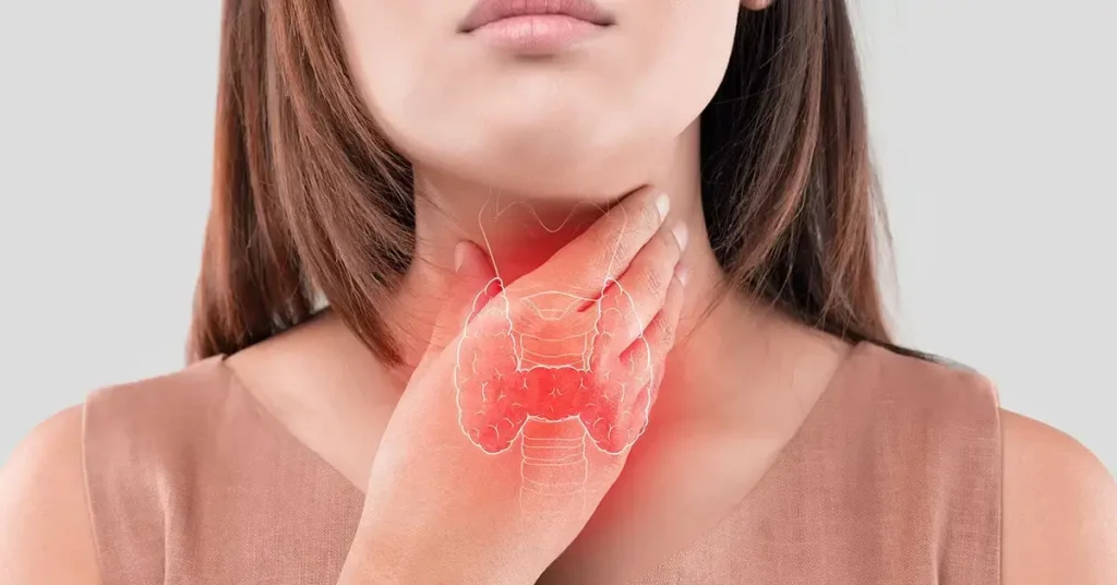 علاج الغدة الدرقية بالاعشاب من قريني بيو